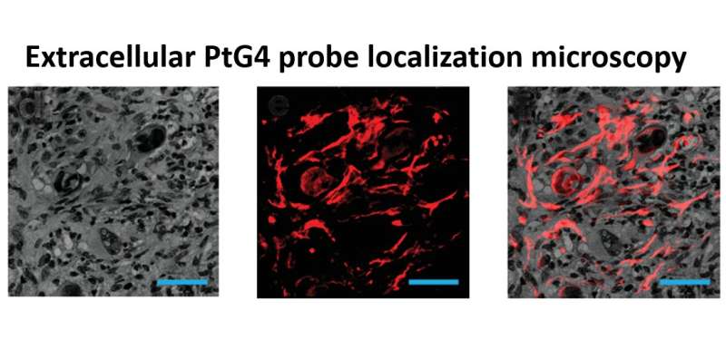 Researchers capture first images of oxygen in cancer tumors during radiation therapy