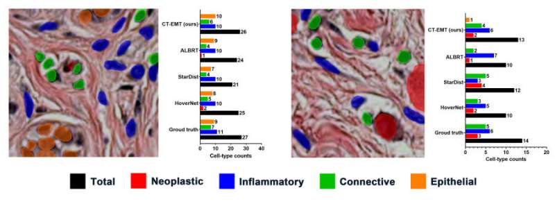 AI-powered deep learning model can improve cancer diagnostics by accurately counting cell types in whole slide images