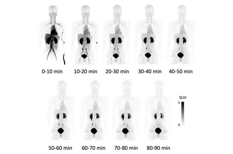 Safety of novel cancer-specific PET probe confirmed in clinical research