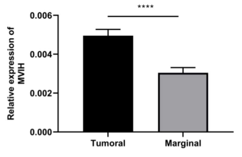 Genes &amp; Cancer | Ectopic expression of lncRNA MVIH as a potential diagnostic biomarker in cervical cancer