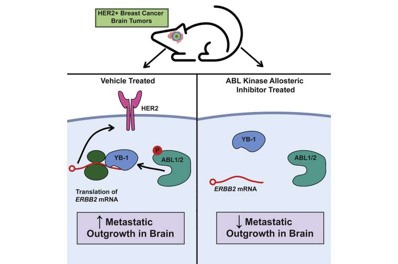 Leukemia drug shows potential against metastatic HER2-positive breast cancer 