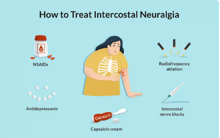 Causes of Intercostal Neuralgia and How to Get Relief