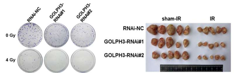 New mechanism of radioresistance formation proved in lung adenocarcinoma