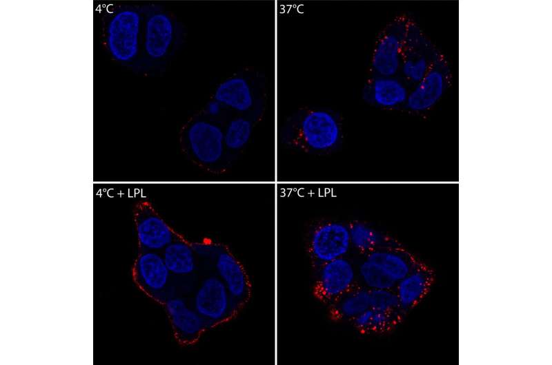 Breast cancer cells swallow a 'free lunch' of dietary fat particles from the bloodstream