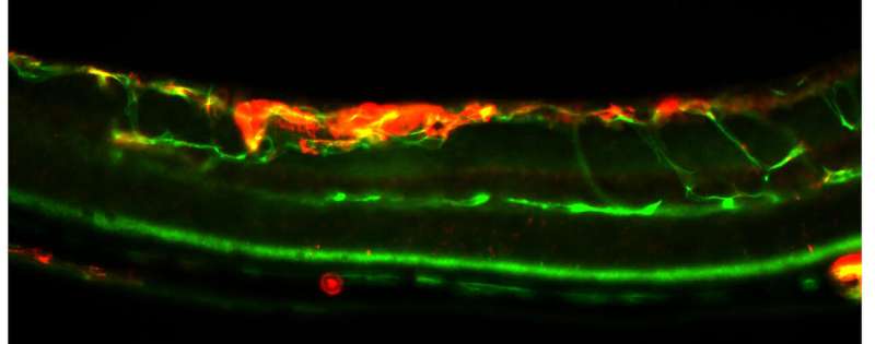 Novel genetic signature that can predict some kinds of breast cancer is identified