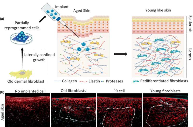 Reprogramming tissue mechanically to promote wound healing 