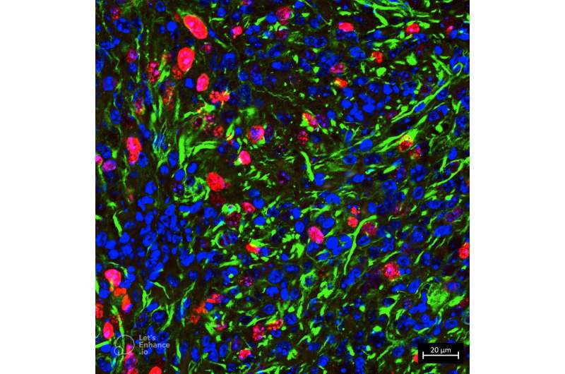 Unraveling the biology behind aggressive pediatric brain tumor reveals potential new treatment avenue