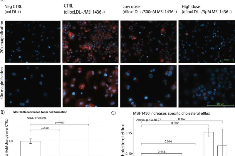 Drug shown to block artery fat takes a major step forward