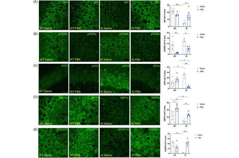 New treatment reverses Alzheimer's disease signs, improves memory function in preclinical study