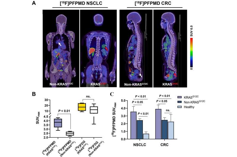 New PET tracer noninvasively identifies cancer gene mutation, allows for more precise diagnosis and therapy