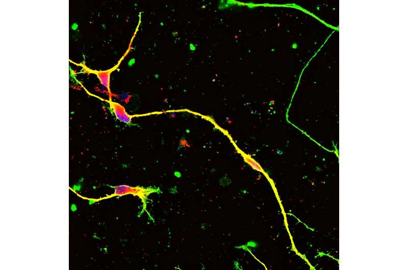 Genome-editing technique shows promise as treatment for common hereditary nerve disease