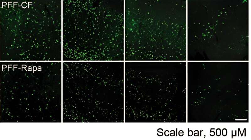 New findings about key pathological protein in Parkinson's disease open paths to novel therapies