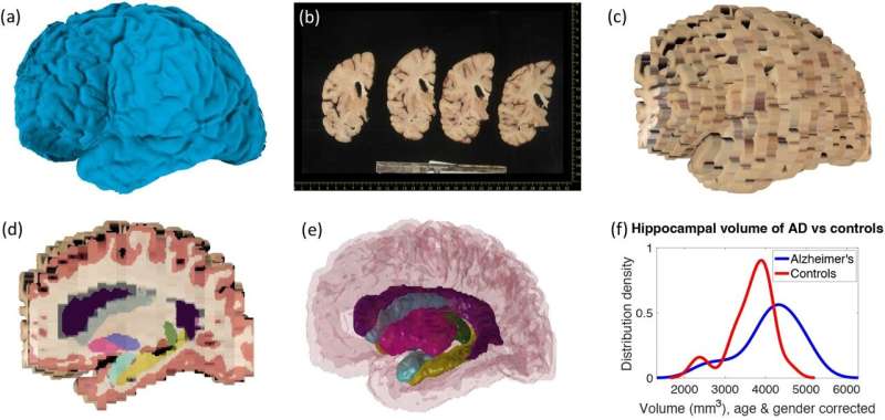 New computer tools can reconstruct 3D brain from biobank photos