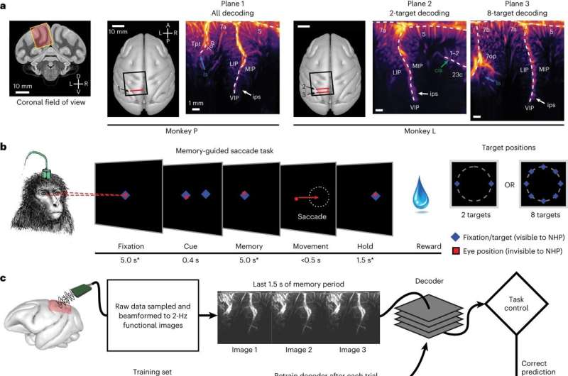 Ultrasound enables less-invasive brain-machine interfaces