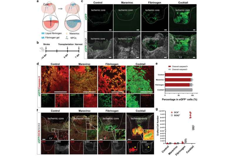 Research reveals novel ways of cultivating brain cells to treat and study