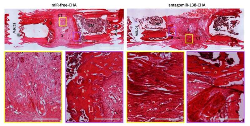 Researchers develop material that reduces bacterial infection and speeds up bone healing