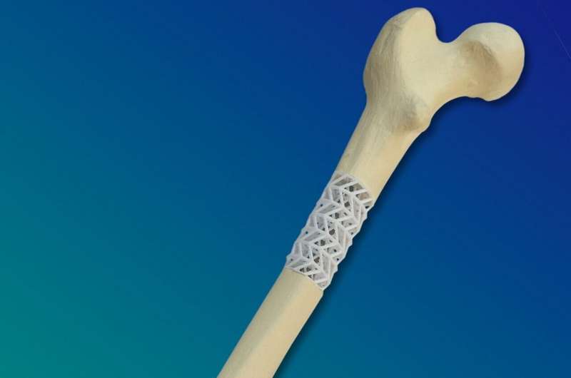 Bioactive composite supports healing of broken bones