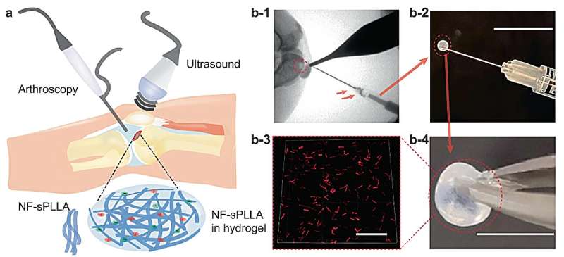 Research team designs gel that repairs cartilage nonsurgically with electricity