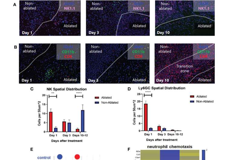 How sound waves trigger immune responses to cancer in mice