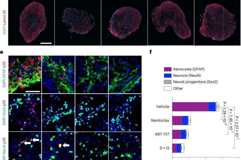 Turning back the clock on brains aged by COVID-19