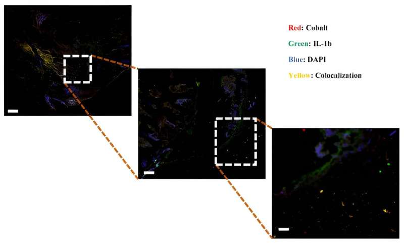 Researchers heal heavy metal poisoning from implants