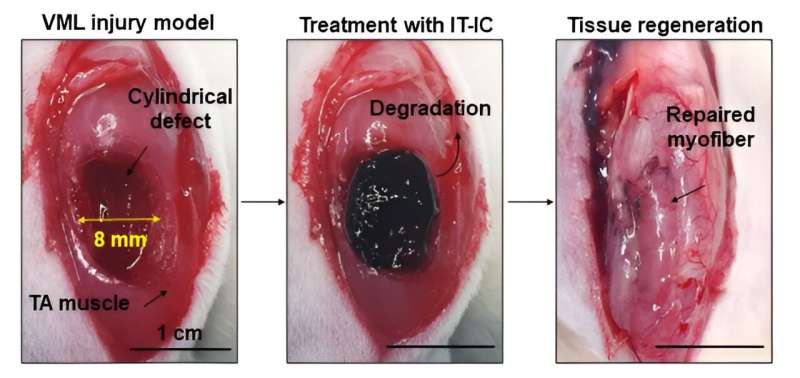 New &quot;injectable tissue prosthesis coupled with closed-loop bioelectronic system&quot; to aid in damaged muscle/nerve regeneration and robot-assisted rehabilitation