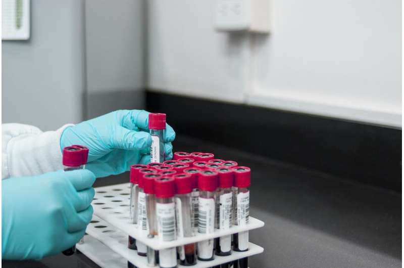 Novel blood test identifies biomarkers in patients with Alzheimer's disease