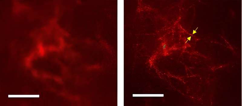 New methodology to study the intricacies of amyloid plaques in Alzheimer's disease