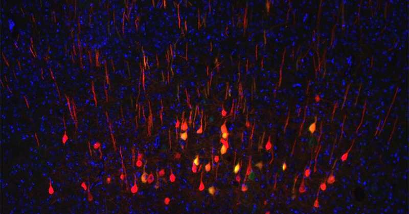 New biomarker predicts whether neurons will regenerate