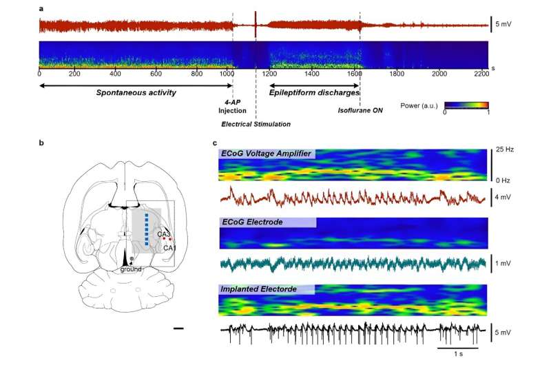 One-stop implementation from signal detection to processing