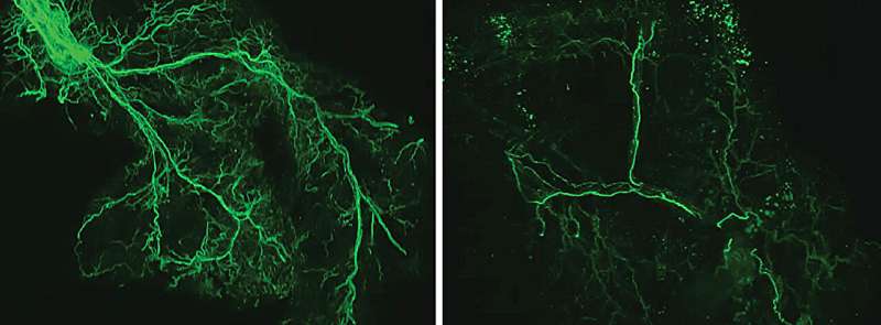 Life span increases in mice when specific brain cells are activated