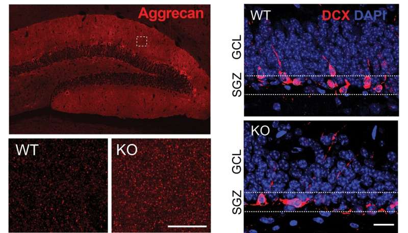 Researchers detail mechanism of a key protein implicated in age-related brain dysfunction