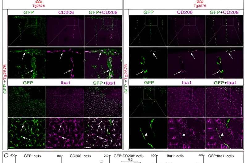 New culprit in amyloid beta buildup, neurodegeneration