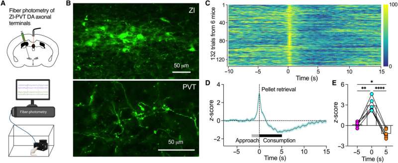 Neuroscientist finds cluster of dopamine neurons drives eating behaviors