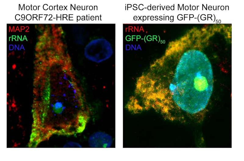 Studies identify novel underpinnings of genetic ALS