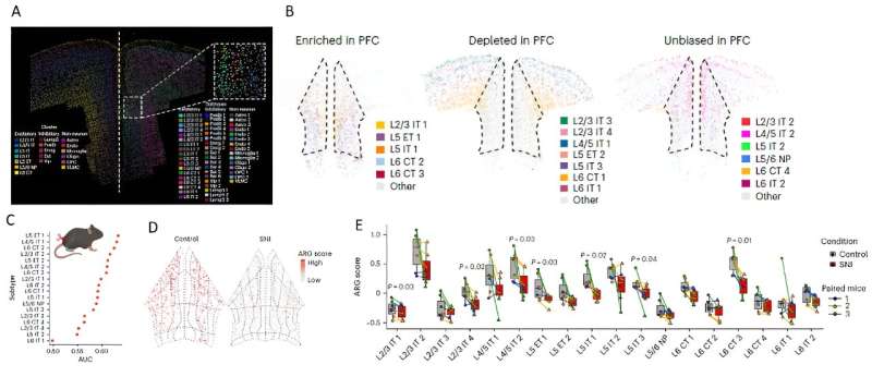 Study unveils organizational complexity of the prefrontal cortex and neuron subtypes regulating chronic pain