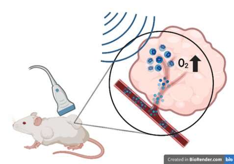 Delivering oxygen to tumors may be key in overcoming radiation therapy resistance