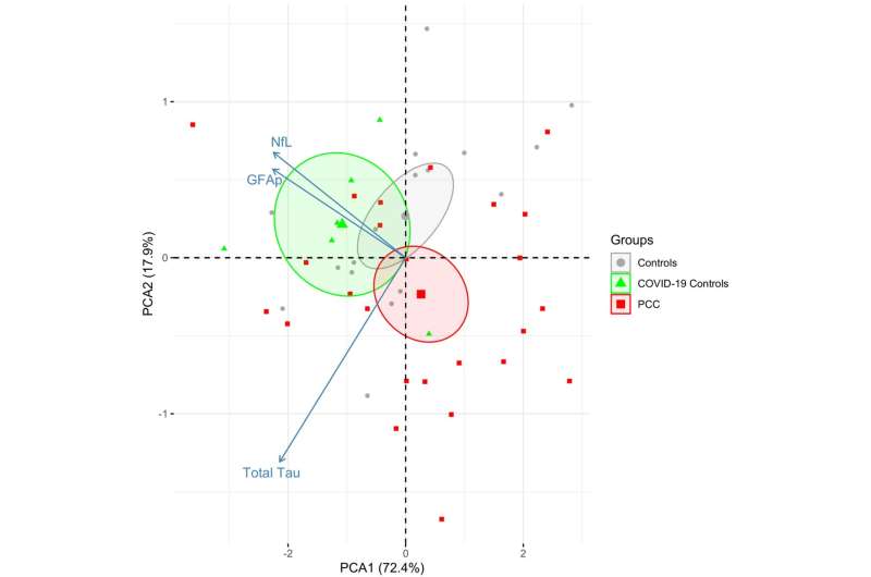 Post-COVID condition is not linked to ongoing infection or active brain damage, study shows