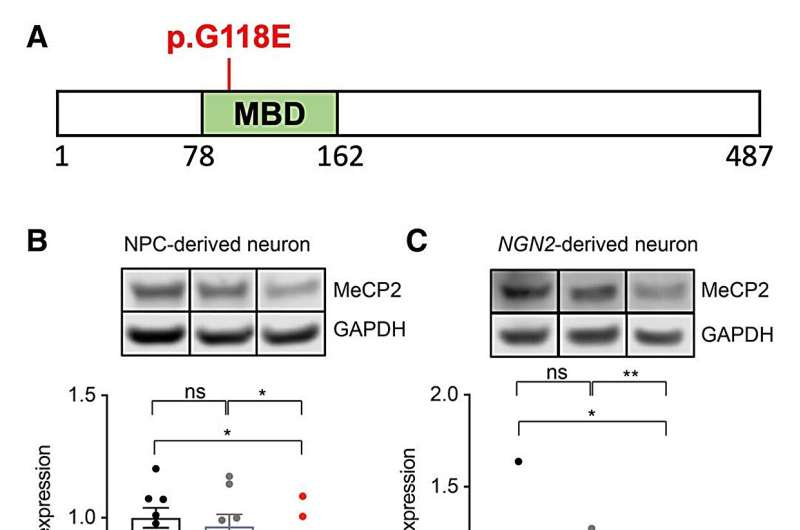 Novel Rett syndrome variant shines light on new screening strategies for therapies