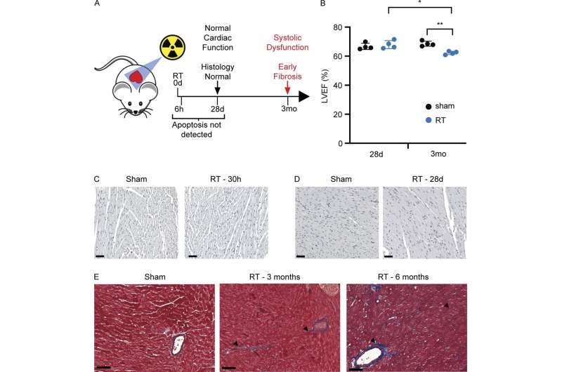 Mouse study suggests new therapeutic strategy to reduce cardiovascular disease in cancer survivors