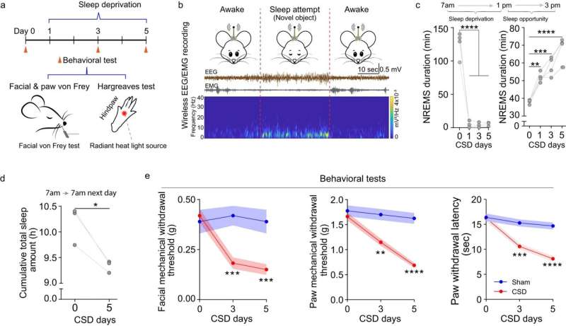 Research reveals how sleep disruption can exacerbate pain