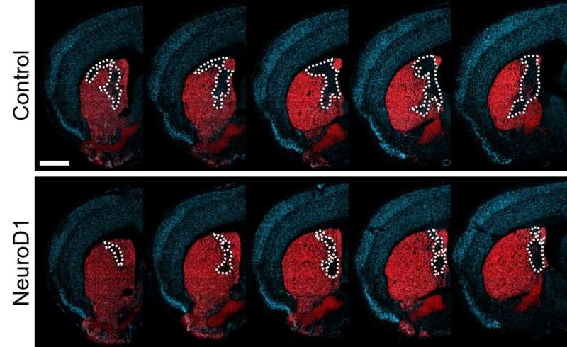 Converting brain immune cells into neurons helps mice recover after stroke