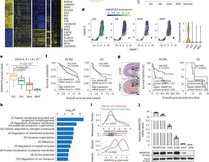 New study uncovers key culprit behind pediatric brain cancer metastasis