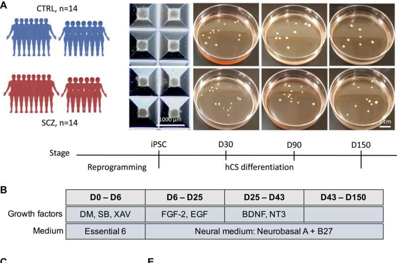 New clues to early development of schizophrenia