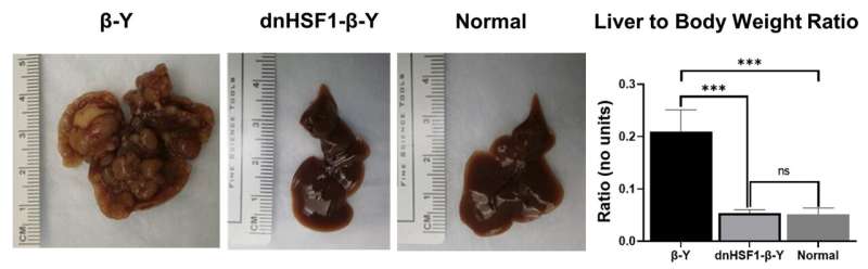 New research identifies a potential treatment target for hepatoblastoma, the most common liver cancer in children