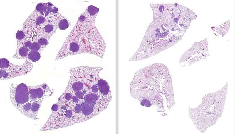 New combination of drugs works together to reduce lung tumors in mice