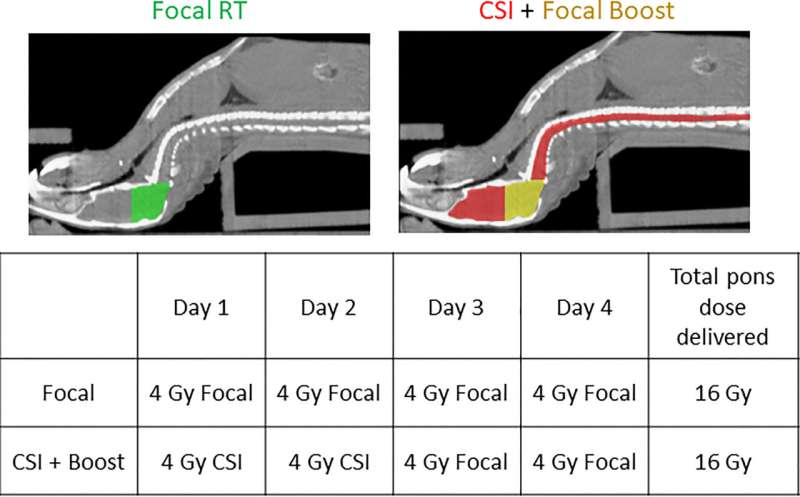 Finding new ways to treat diffuse midline gliomas