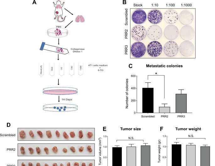 New molecular blocker halts breast cancer metastasis