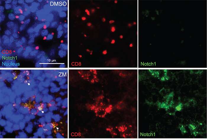 Study reports blocking key enzyme boosts anti-cancer T-cell responses and resistance to immunosuppression