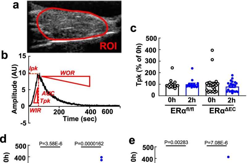 Study reveals how estrogen exerts its anti-diabetic effects